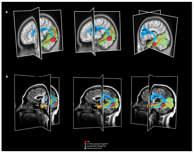 anatomical connection